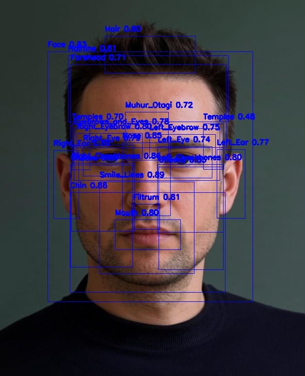 Örnek analiz ekran görüntüsü